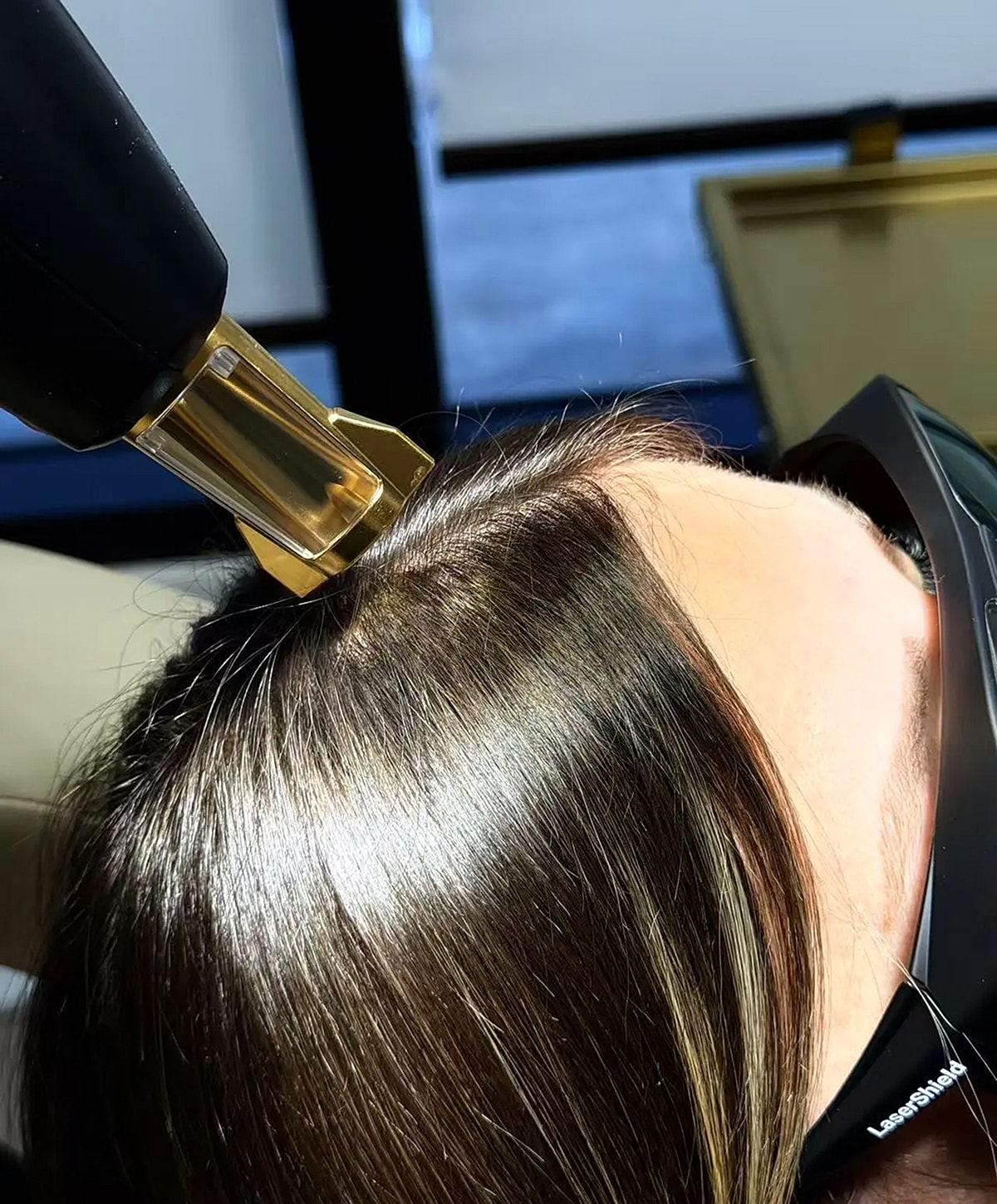 Hair treatment using a professional laser device.