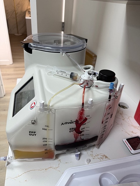 Medical blood separation machine on a countertop.