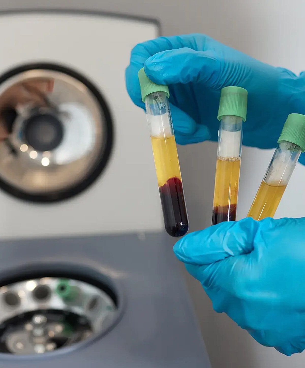 Laboratory technician holding test tubes with samples.