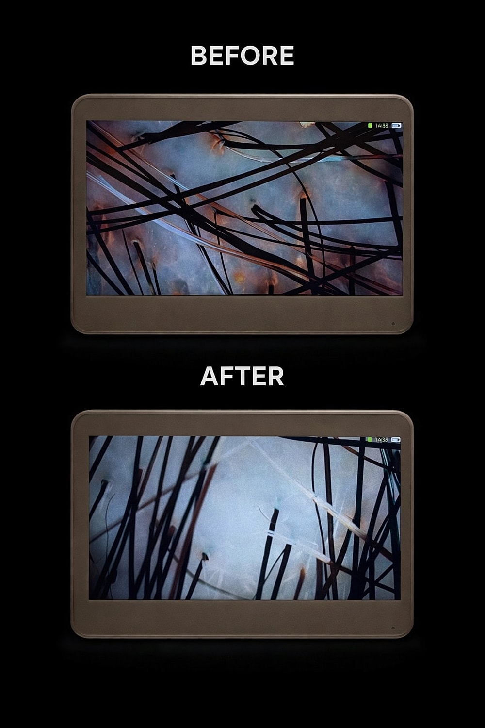 Scalp Treatment Before & After