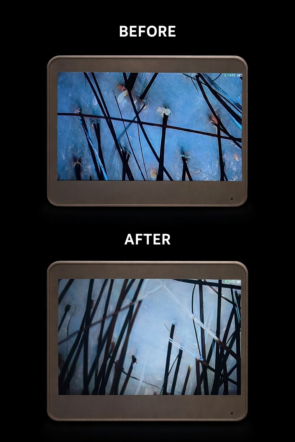 Scalp Treatment Before & After