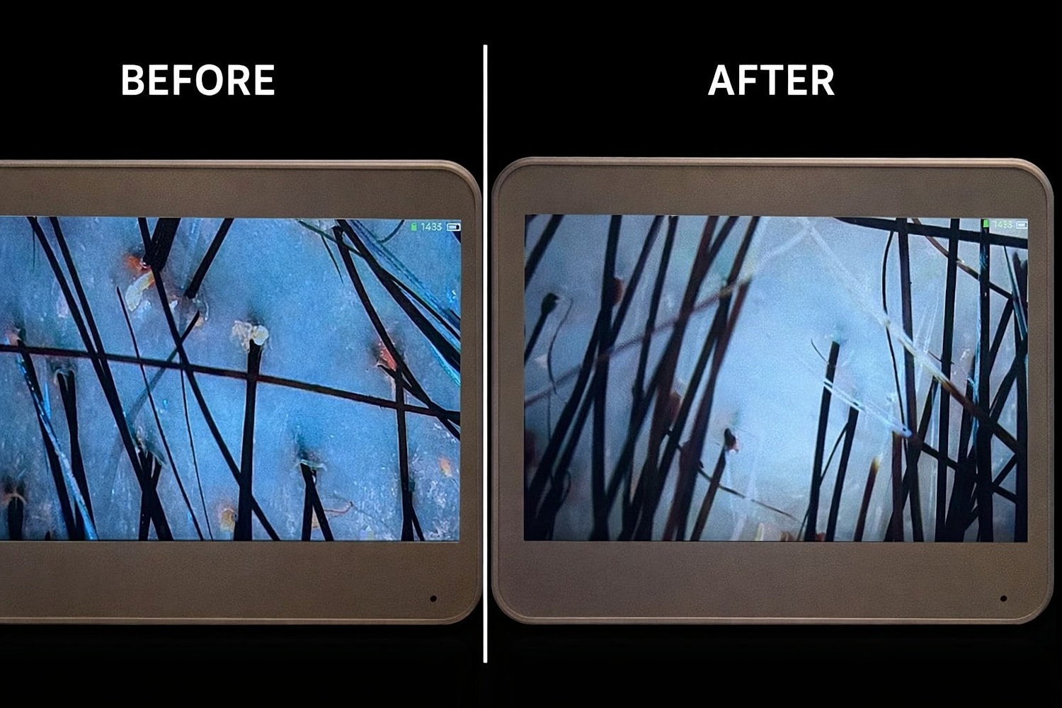 Scalp Treatment Before & After